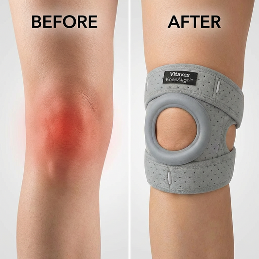 Why Knee Support Matters More Than You Think